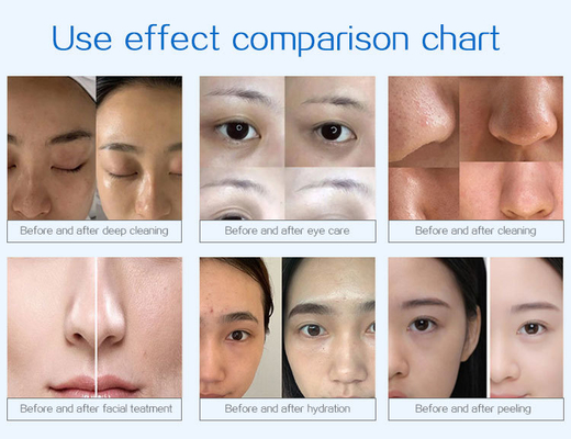 Professional Spa 14in1 Korean Hydra Dermabrasion Facial Machine Hydro H2o2 Bubble Microdermabrasion Facial Machine