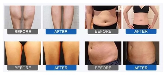 Detox Body Belly Leg Balancer Pressotherapy Suit Lymphatic Drainage Slimming Body Detox Fat Reduce Warm Machine